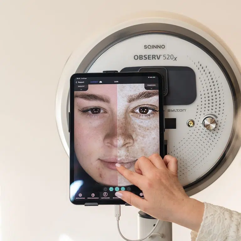 Huidanalyse met de Observ 520X huidscan bij Dessa Skin